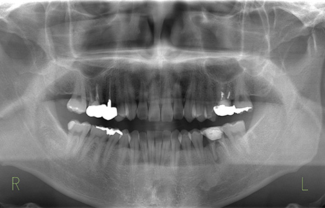Before image