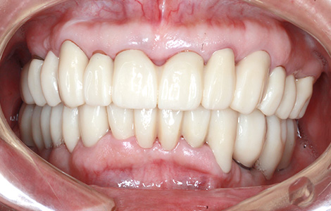 After image