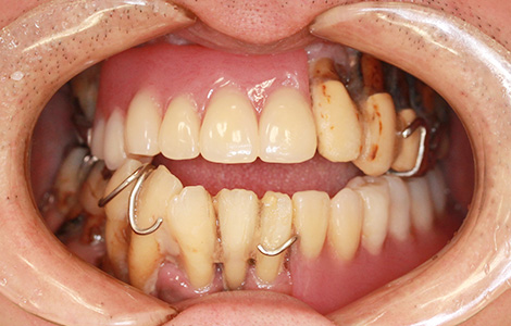 Before image