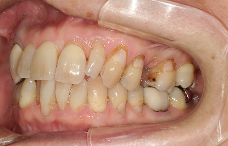 Before image