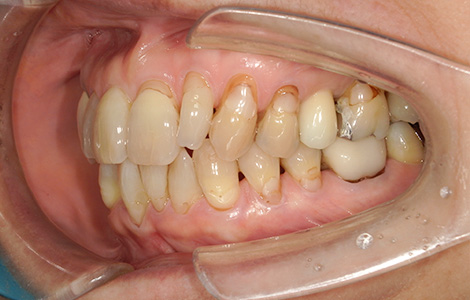 After image