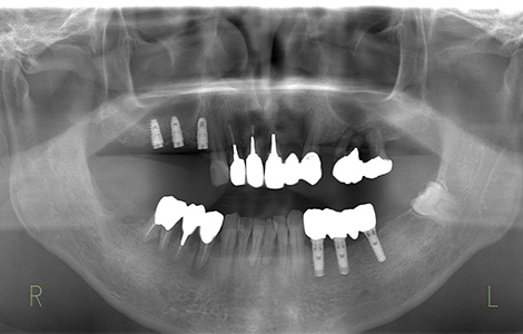 After image