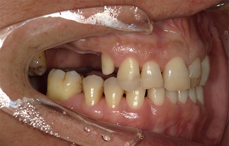Before image