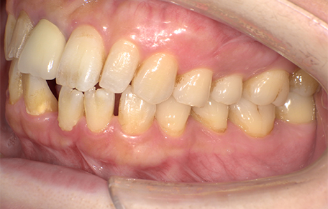 Before image
