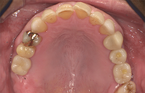 After image