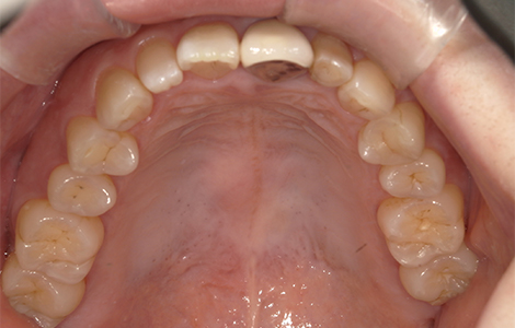 After image
