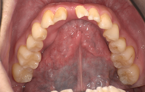 Before image