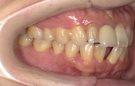 Before image
