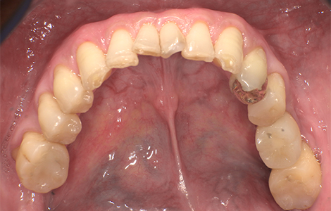 After image