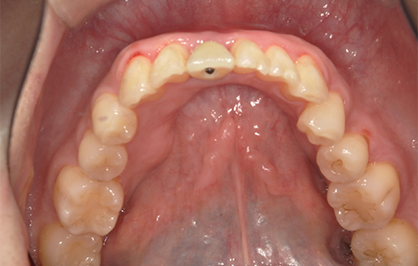After image