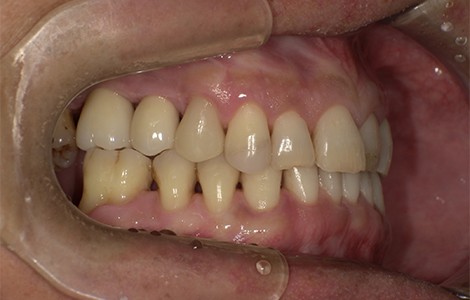 After image