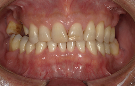Before image