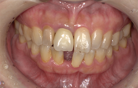 Before image