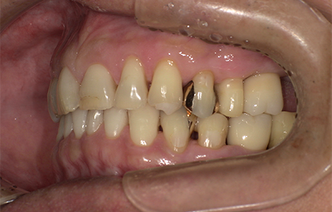 After image