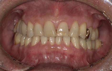 After image