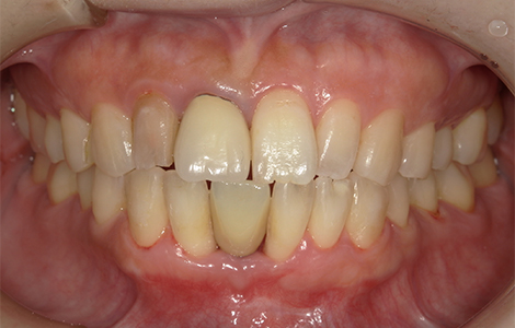After image
