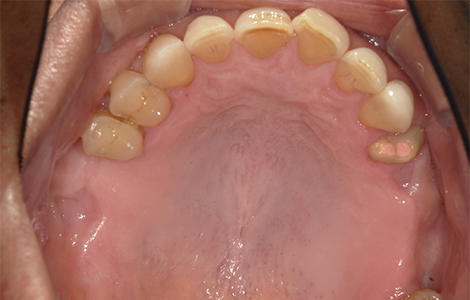 Before image