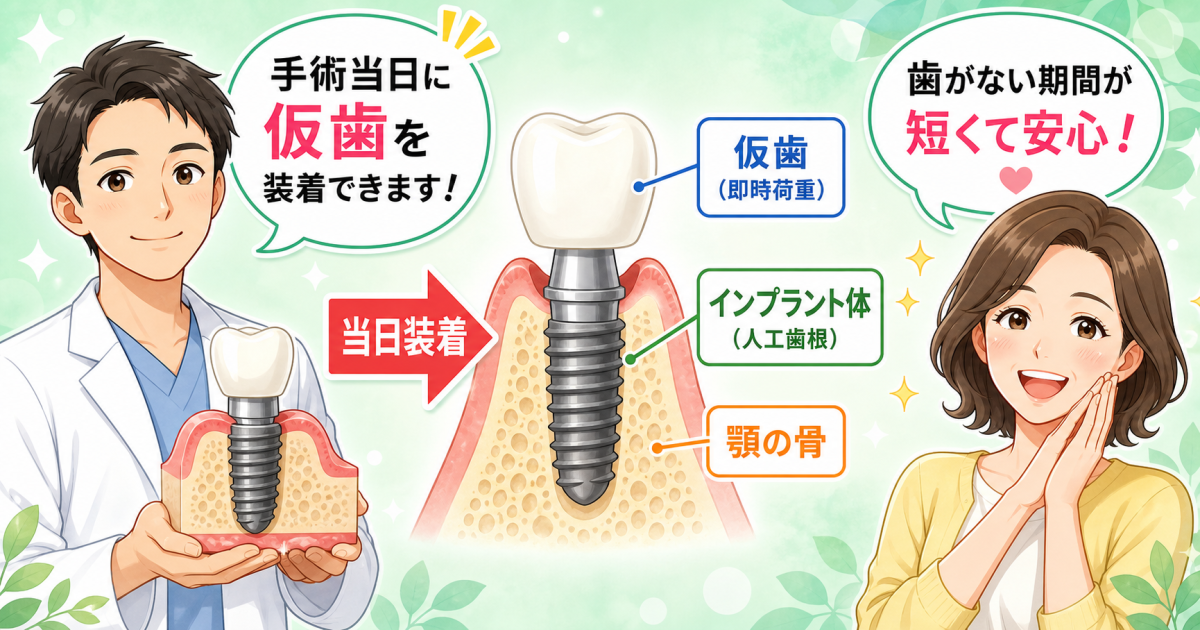■インプラントの仮歯と「即時荷重」の基本を知る