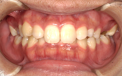 Before image