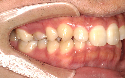 Before image