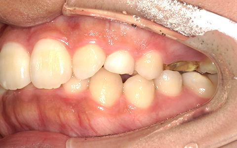Before image