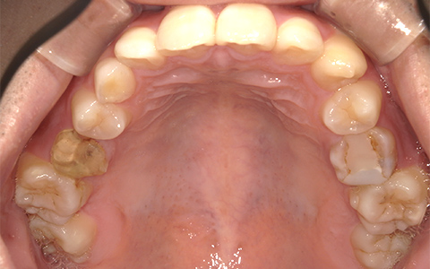 Before image