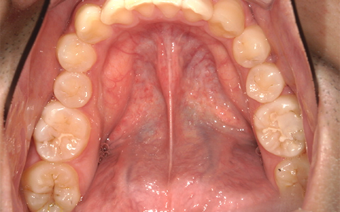 Before image