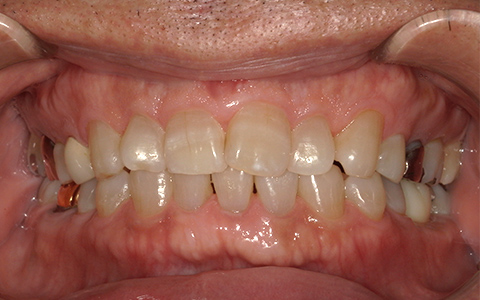 After image