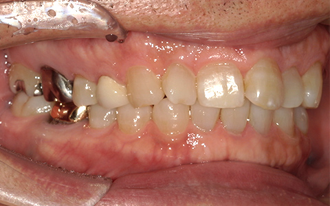 After image