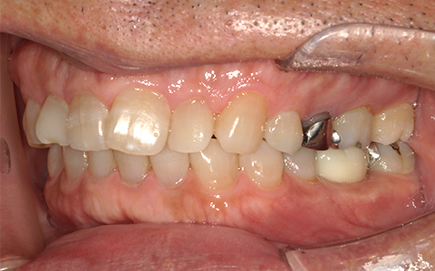 After image