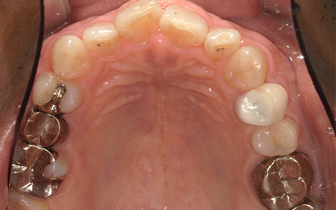 After image