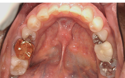 After image