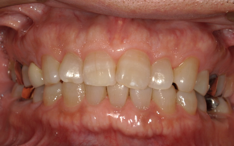 Before image