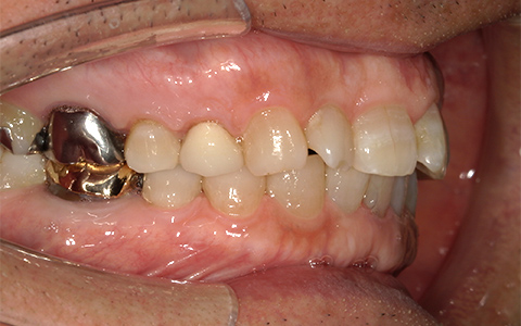 Before image