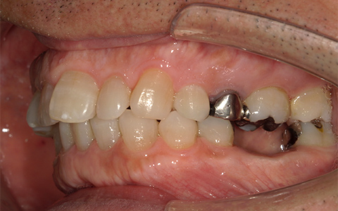 Before image