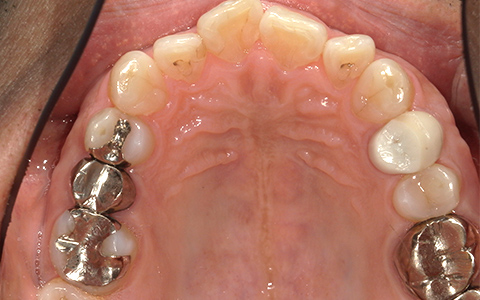 Before image