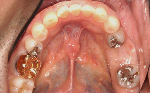 Before image