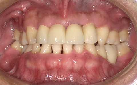 After image