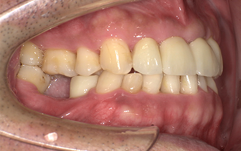 After image