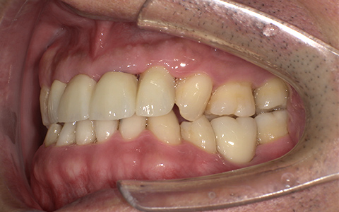 After image