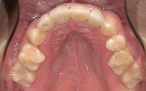 After image