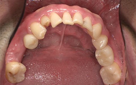 After image