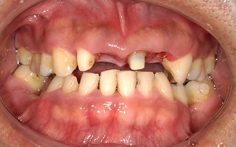 Before image