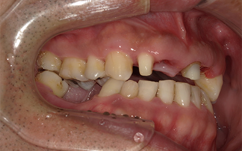 Before image