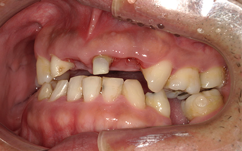 Before image