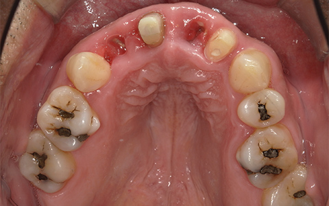 Before image