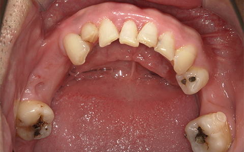 Before image