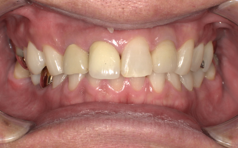 After image
