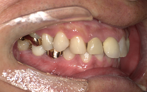 After image