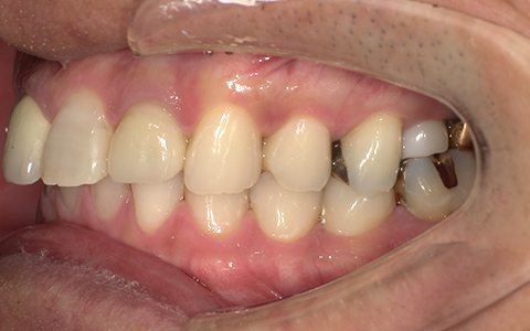 After image
